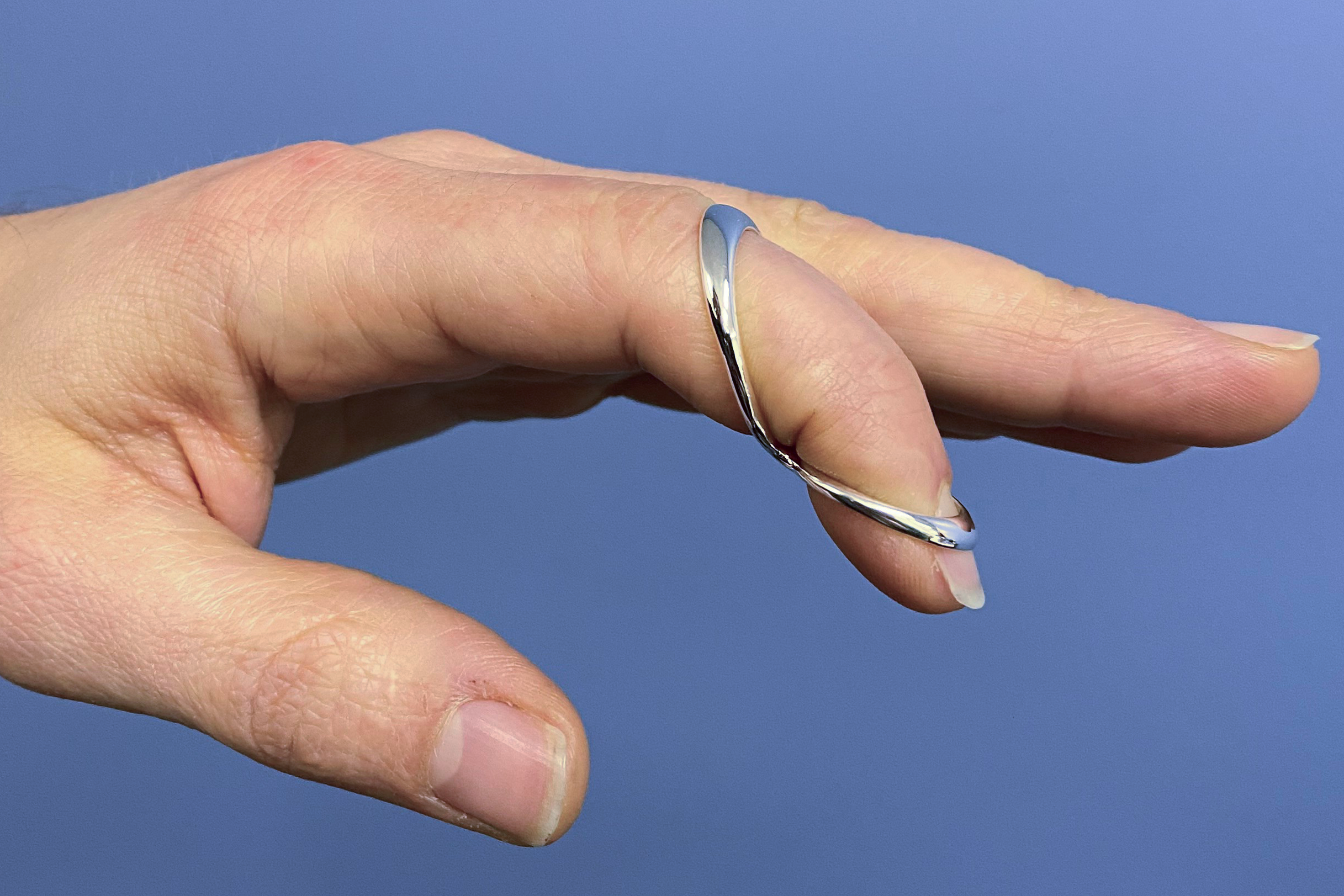 Forced Flexion Splint