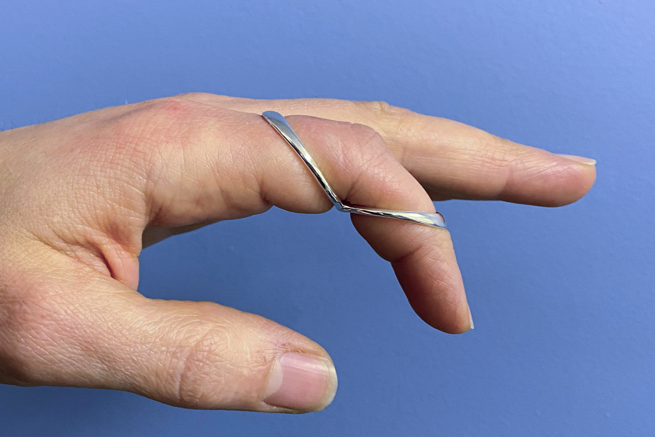 Forced Flexion Splint